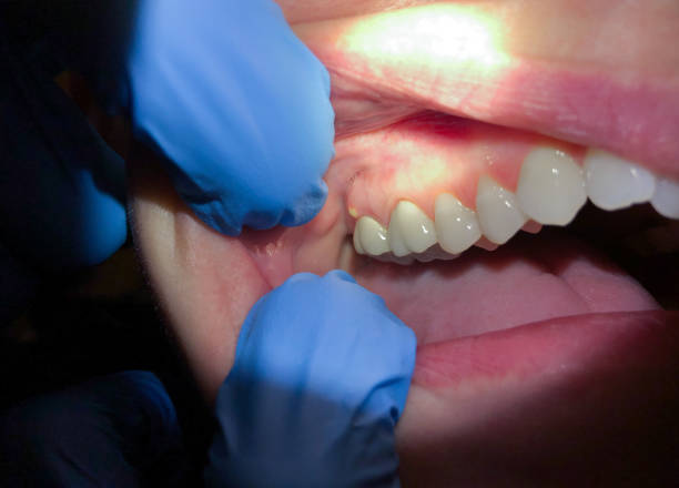 Best Emergency Dentist for Knocked-Out Tooth in Clayton, NJ
